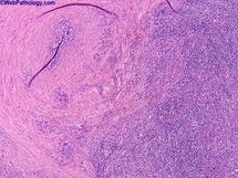 الحيوانات المنوية للاذكياء أفضل وللمتشمسين أغزر الحيوانات المنوية للاذكياء أفضل وللمتشمسين أغزر