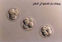 اطباء اسرائيلون يهربون البويضات الرومانية لعمليات التلقيح بالانابيب اطباء اسرائيلون يهربون البويضات الرومانية لعمليات التلقيح بالانابيب