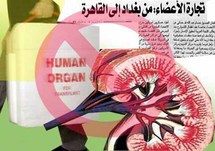 سوق رائجة لتجارة الأعضاء البشرية في مصر وسط غياب التشريعات الضابطة