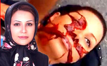 ندى آغا سلطان قبل وبعد أستشهادها في شوارع طهران