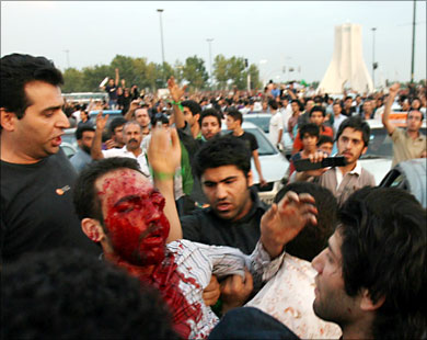 دماء في شوارع طهران ومدن اخرى في يوم عاشوراء