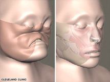 زراعة وجة كامل