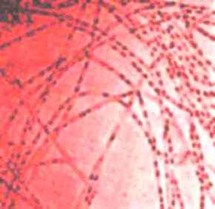 الجمرة الخبيثة مرض شديد العدوى الجمرة الخبيثة مرض شديد العدوى