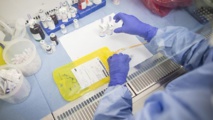 خبراء يعلنون نتائج إيجابية لعلاج سرطان الدم بـ"الخلايا القاتلة"