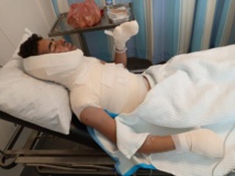 لبنانيون يضرمون النار بشاب سوري في بيروت لبنانيون يضرمون النار بشاب سوري في بيروت