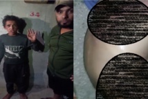 الطفل وبعض اثار التعذيب- شام