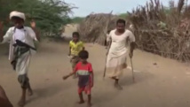 ارشيفية ...الحرب لا تخلف غير المجاعات والجرحى والمقعدين