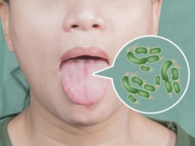 بكتيريا الفم تزيد من خطر الإصابة بسرطانات فتاكة بنسبة النصف بكتيريا الفم تزيد من خطر الإصابة بسرطانات فتاكة بنسبة النصف