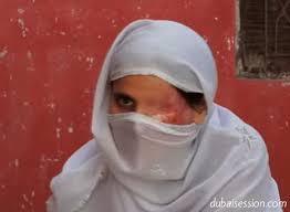 مهاجمة ثلاث نساء بمادة حارقة بسبب خلاف عائلي في باكستان