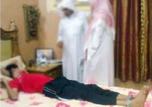 سعودي مريض نفسيا يعيش مقيداً بالسلاسل منذ 28 عاماً