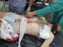 عمليات راسعاف لبعض الجرحى -الشرق نيوز عمليات راسعاف لبعض الجرحى -الشرق نيوز