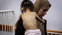 مفوض الأمم المتحدة السامي لحقوق الإنسان، فولكر تورك: إنقاذ الأرواح يجب أن تكون أولوية الجميع وحرمان المدنيين من الوصول إلى الغذاء يعتبر جريمة حرب، وربما تشكل جريمة ضد الإنسانية.. - الاناضول