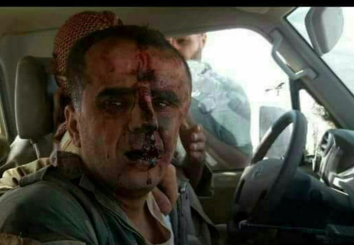 الجيش السوري يؤكد سقوط إحدى طائراته الحربية بريف السويداء