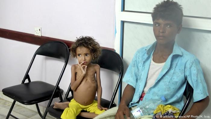 الأمم المتحدة : نصف اليمنيين تقريبا على شفا المجاعة