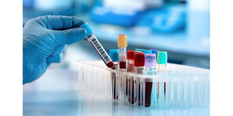 شركة المانية تطور دواء لكورونا يعتمد على بلازما الدم  