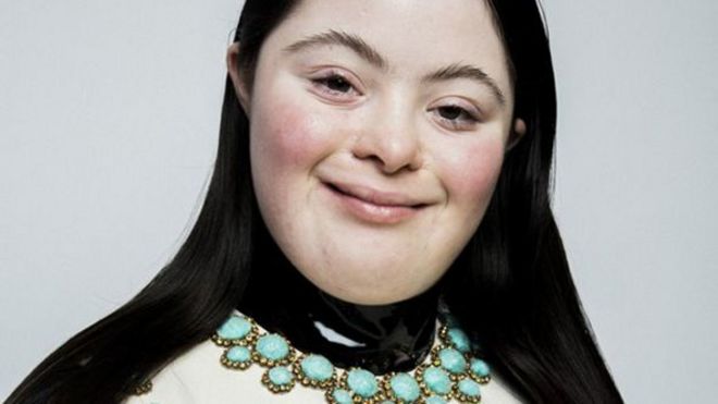 لأول مرة عارضة أزياء بمتلازمة داون تظهر في مجلة فوغ