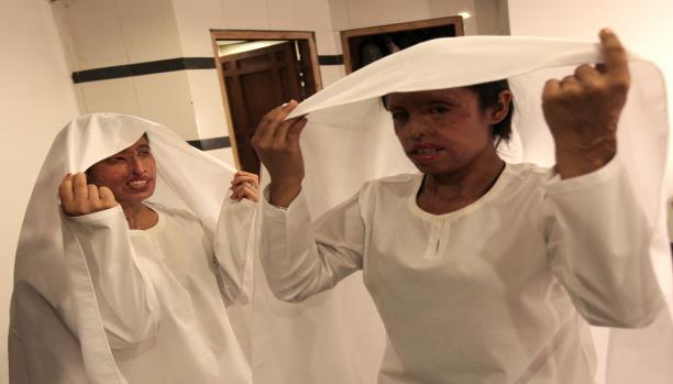 هجمات جديدة بالحمض ضد النساء في باكستان