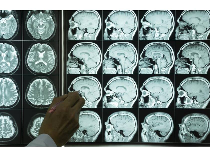 دراسة سويسرية تتوصل إلى وجود علاقة بين المال وشيخوخة الإنسان