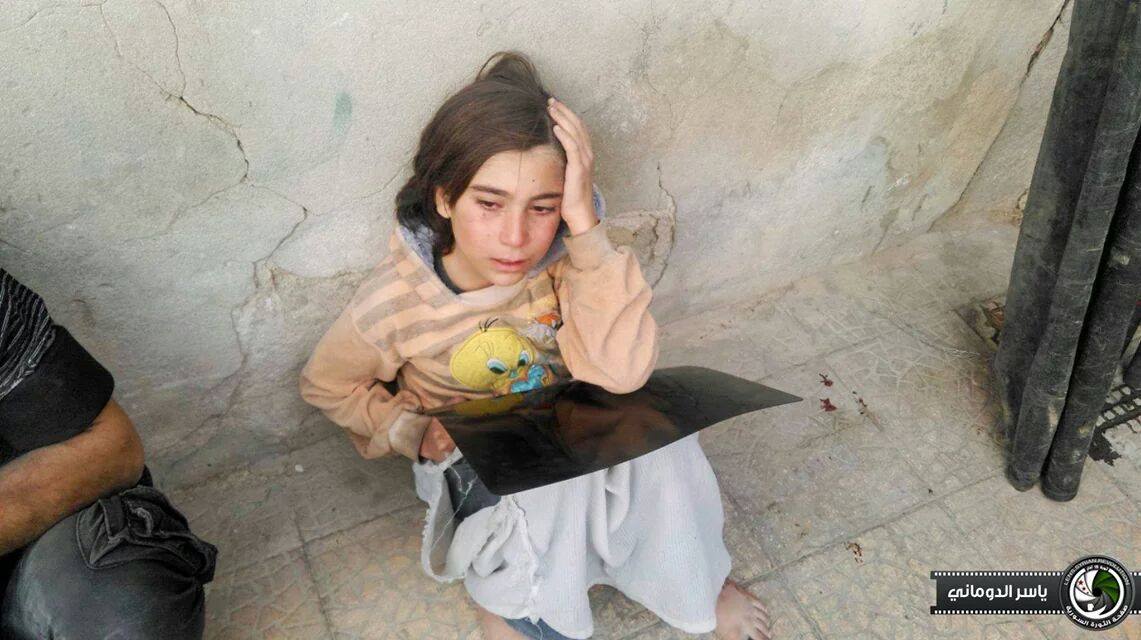 قتلى القصف على دوما بارتفاع والامم المتحدة تعرب عن "ذهولها"