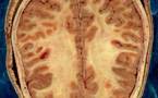 علماء ألمان يطورون جهاز عالي التقنية يوفر صورا أدق للمخ