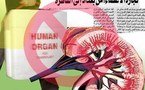 سوق رائجة لتجارة الأعضاء البشرية في مصر وسط غياب التشريعات الضابطة