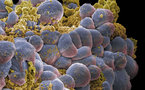 اكتشاف جسم مضاد يهاجم الخلايا السرطانية في البروستات