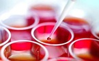 علماء يطورون خلايا جذعية  لعلاج الشلل وأعصاب العين