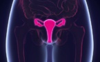 مخاوف طبية من جراحة جديدة لـ "تأجيل انقطاع الطمث"