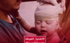  منظمات مجتمع مدني تقاضي نظام الأسد لاستخدامه "الكيماوي"  